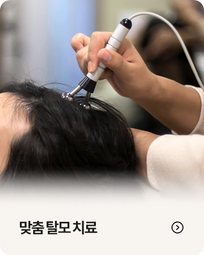 맞춤 탈모 치료