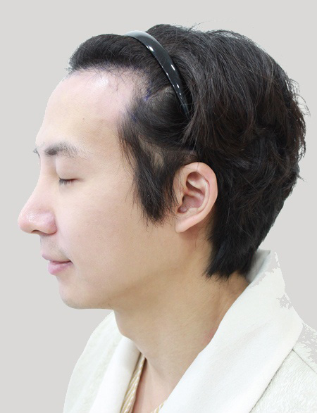 수술 전 상태