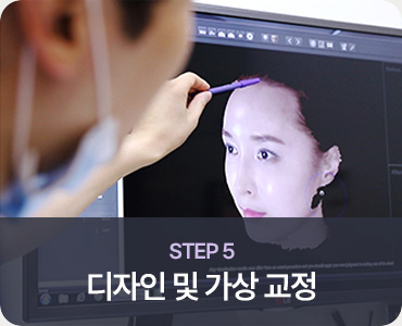 모발이식 STEP 5 디자인 및 가상 교정