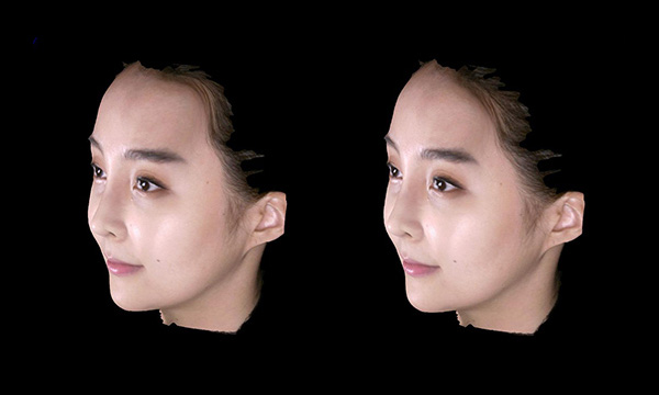 3D 입체 스캐너를 이용한 분석