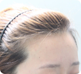 수술 전 상태
