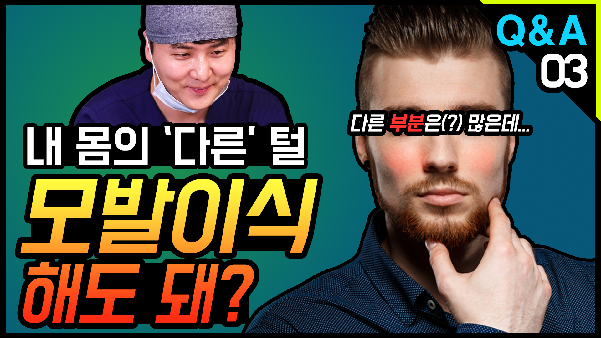 영상 썸네일