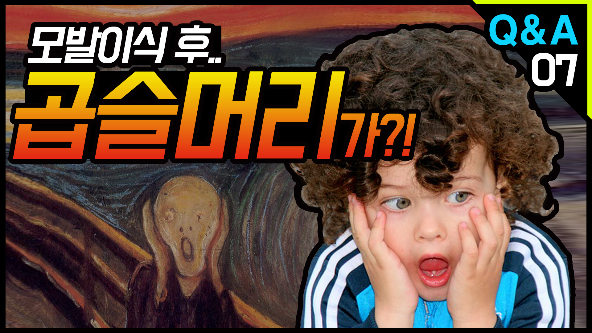 영상 썸네일
